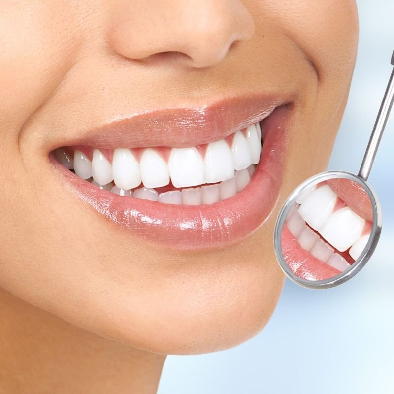 Diseño De Sonrisa / Estética Dental - NeoDonto