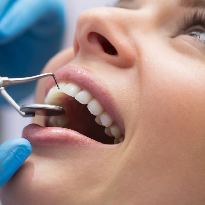 Rehabilitación Oral - NeoDonto